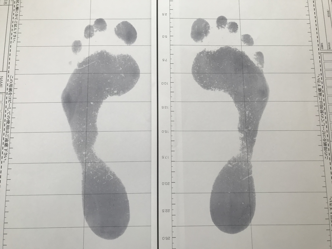 腰痛は、足の裏から治す！